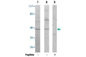 Western blot analysis of extracts from Jurkat cells (Lane 1) and COLO 205 cells (Lane 2 and lane 3), using ACTL6A polyclonal antibody . (BAF53A 抗体)