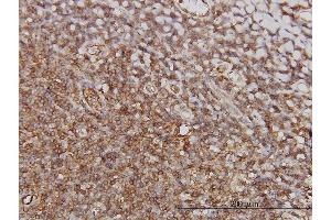 Immunoperoxidase of monoclonal antibody to PTGIR on formalin-fixed paraffin-embedded human tonsil. (Prostacyclin Receptor 抗体  (AA 296-386))