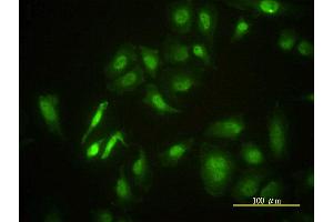 Immunofluorescence of monoclonal antibody to STK4 on HeLa cell. (STK4 抗体  (AA 1-39))