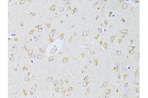 Immunohistochemistry of paraffin-embedded rat brain using NTS antibody (ABIN6290694) at dilution of 1:100 (40x lens). (Neurotensin 抗体)