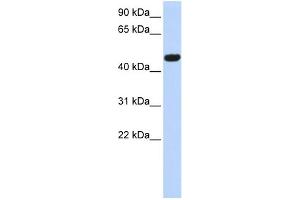 Western Blotting (WB) image for anti-Calcium Channel, Voltage-Dependent, beta 4 Subunit (CACNB4) (Middle Region) antibody (ABIN2774681)