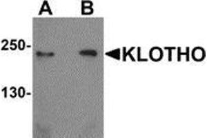 Western blot analysis of KLOTHO in rat heart tissue lysate with KLOTHO antibody at (A) 1 and (B) 2 μg/ml. (Klotho 抗体  (Center))