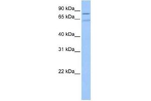 ZNF724P antibody used at 0. (ZNF724P 抗体  (N-Term))