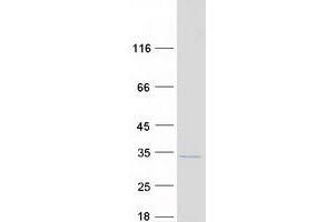 Western Blotting (WB) image for PARK2 Co-Regulated (PACRG) (Transcript Variant 2) protein (Myc-DYKDDDDK Tag) (ABIN2728106)