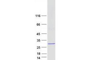 Western Blotting (WB) image for RAB7B, Member RAS Oncogene Family (RAB7B) (Transcript Variant 2) protein (Myc-DYKDDDDK Tag) (ABIN2730369)