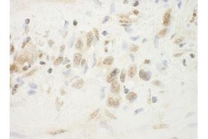 anti-Folliculin (FLCN) (AA 1-50) antibody