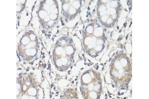 Immunohistochemistry of paraffin-embedded Human colon using FAK Polyclonal Antibody at dilution of 1:100 (40x lens). (FAK 抗体)