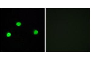 Immunofluorescence (IF) image for anti-Inositol Hexakisphosphate Kinase 2 (IP6K2) (Internal Region) antibody (ABIN1850058) (IP6K2 抗体  (Internal Region))