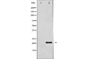 Western blot analysis of Survivin expression in Mouse lungtissue lysates,The lane on the left is treated with the antigen-specific peptide. (Survivin 抗体  (Internal Region))