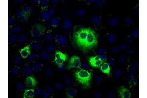 Image no. 4 for anti-thromboxane A Synthase 1 (Platelet) (TBXAS1) antibody (ABIN1501382)