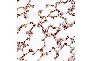 Immunohistochemistry (Paraffin-embedded Sections) (IHC (p)) image for anti-Chloride Intracellular Channel 6 (CLIC6) antibody (ABIN7073478)