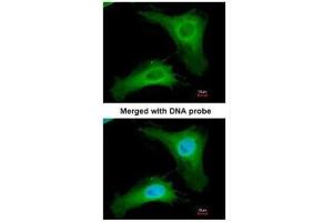 ICC/IF Image Immunofluorescence analysis of paraformaldehyde-fixed HeLa, using PHLP, antibody at 1:200 dilution. (Phosducin-Like 抗体)