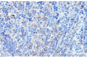 Immunohistochemistry of paraffin-embedded Mouse spleen using MADCAM1 Polyclonal Antibody at dilution of 1:100 (40x lens). (MADCAM1 抗体)
