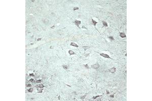 Immunohistochemistry (IHC) image for anti-Vacuolar Protein Sorting 45 (VPS45) antibody (ABIN351329)