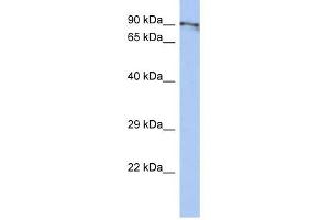 CXORF20 antibody used at 1 ug/ml to detect target protein. (BEND2 抗体  (Middle Region))