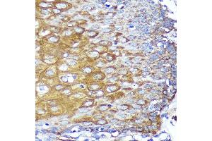 Immunohistochemistry of paraffin-embedded Human esophageal using CYB5R1 Rabbit pAb (ABIN7266630) at dilution of 1:100 (40x lens). (CYB5R1 抗体  (AA 1-305))
