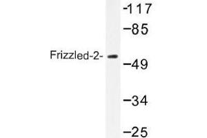 Image no. 1 for anti-Frizzled Family Receptor 2 (FZD2) antibody (ABIN317860) (FZD2 抗体)