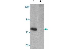 Western blot analysis of SESTD1 in rat brain tissue lysate with SESTD1 polyclonal antibody  at 1 ug/mL in (1) the absence and (2) the presence of blocking peptide. (SESTD1 抗体  (C-Term))