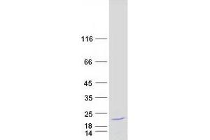 Western Blotting (WB) image for PCNA Clamp Associated Factor (PAF) (Transcript Variant 1) protein (Myc-DYKDDDDK Tag) (ABIN2728137)