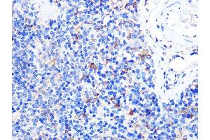 Immunohistochemistry of paraffin-embedded mouse spleen using CD40L Rabbit pAb (ABIN6133614, ABIN6138190, ABIN6138191 and ABIN6216826) at dilution of 1:100 (40x lens).