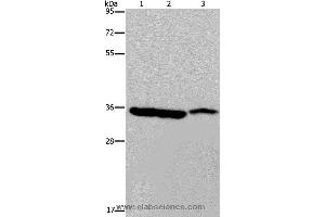 Western blot analysis of Mouse heart, liver and stomach tissue, using MDH1 Polyclonal Antibody at dilution of 1:500 (MDH1 抗体)