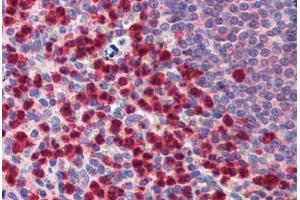 Human Spleen: Formalin-Fixed, Paraffin-Embedded (FFPE) (Caspase 9 抗体  (AA 299-318))