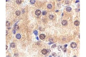 Immunohistochemistry of Il1rl1 in mouse kidney tissue with Il1rl1 polyclonal antibody  at 2 ug/mL . (IL1RL1 抗体  (N-Term))