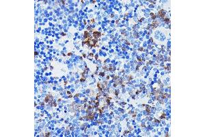 Immunohistochemistry of paraffin-embedded mouse spleen using BTK Rabbit mAb (ABIN7265950) at dilution of 1:100 (40x lens). (BTK 抗体)