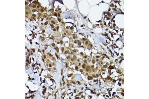 Immunohistochemistry (IHC) image for anti-Signal Transducer and Activator of Transcription 3 (Acute-Phase Response Factor) (STAT3) antibody (ABIN7270305)