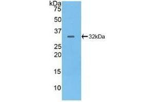 Western Blotting (WB) image for anti-Protein tyrosine Phosphatase, Receptor Type, B (PTPRB) (AA 1655-1918) antibody (ABIN7439990)