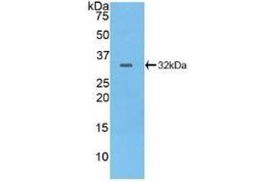 Detection of Recombinant PTPRB, Human using Polyclonal Antibody to Protein Tyrosine Phosphatase Receptor Type B (PTPRB) (PTPRB 抗体  (AA 1655-1918))