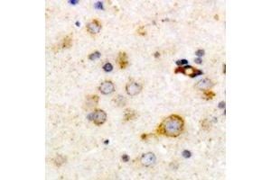 Immunohistochemical analysis of Clusterin staining in human brain formalin fixed paraffin embedded tissue section. (Clusterin 抗体)