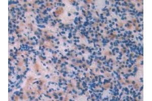 Detection of LCAT in Rat Spleen Tissue using Polyclonal Antibody to Lecithin Cholesterol Acyltransferase (LCAT) (LCAT 抗体  (AA 41-210))