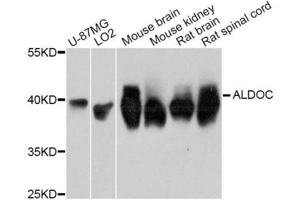 ALDOC 抗体  (AA 1-170)