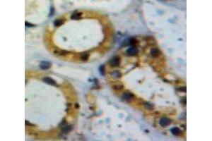 IHC-P analysis of Kidney tissue, with DAB staining. (ACVR1 抗体  (AA 208-340))