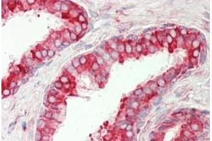 Human Prostate: Formalin-Fixed, Paraffin-Embedded (FFPE) (PDIA4 抗体  (AA 9-37))