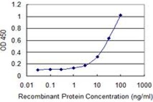 Detection limit for recombinant GST tagged EDC4 is 0. (EDC4 抗体  (AA 1302-1401))