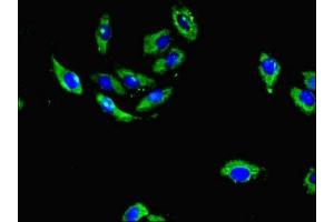 Immunofluorescent analysis of A549 cells using ABIN7142053 at dilution of 1:100 and Alexa Fluor 488-congugated AffiniPure Goat Anti-Rabbit IgG(H+L) (PLCD4 抗体  (AA 1-290))