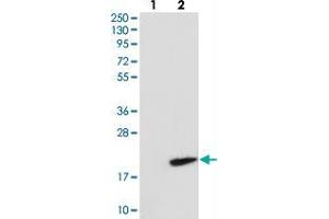 Western blot analysis of Lane 1: Negative control (vector only transfected HEK293T lysate), Lane 2: Over-expression Lysate (Co-expressed with a C-terminal myc-DDK tag (~3. (RNF7 抗体)