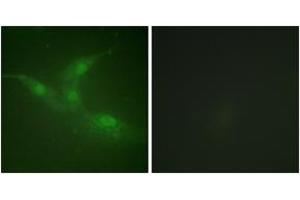 Immunofluorescence analysis of NIH-3T3 cells, using Breast Tumor Kinase (Phospho-Tyr447) Antibody. (PTK6 抗体  (pTyr447))