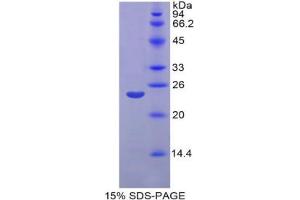 SDS-PAGE analysis of Rat Matrix Metalloproteinase 11 (MMP11) Protein. (MMP11 蛋白)