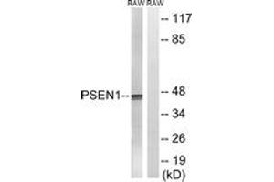 Western blot analysis of extracts from Raw264. (Presenilin 1 抗体  (AA 323-372))