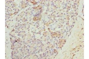 Immunohistochemistry of paraffin-embedded human pancreatic tissue using ABIN7161122 at dilution of 1:100 (N4BP2L2 抗体  (AA 1-300))