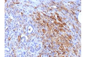 Immunohistochemistry (IHC) image for anti-Ferritin, Light Polypeptide (FTL) (AA 38-165) antibody (ABIN6939458)