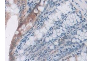 Detection of LEPR in Mouse Colon Tissue using Polyclonal Antibody to Leptin Receptor (LEPR)