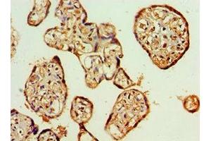 Immunohistochemistry of paraffin-embedded human placenta tissue using ABIN7144665 at dilution of 1:100 (AIPL1 抗体  (AA 1-384))