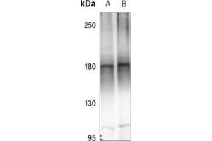 Western blot analysis of MEKK4 expression in A549 (A), EC9706 (B) whole cell lysates. (MAP3K4 抗体  (C-Term))