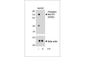 Western blot analysis of lysates from Jurkat cell line, untreated or treated with calf intestinal alkaline phosphatase(CIP), using Phospho-MeCP2 Antibody (upper) or Beta-actin (lower). (MECP2 抗体  (pSer423))