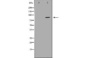 Western blot analysis of Hepg2 whole cell lysates, using CFB Antibody. (Complement Factor B 抗体  (Internal Region))