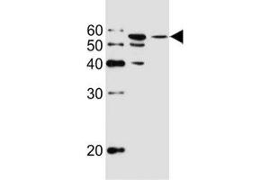 Western blot analysis of lysate from MCF-7, T47D cell line (left to right) using ALDH6A1 antibody at 1:1000 for each lane.